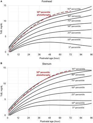 The use of transcutaneous bilirubin nomograms for the prevention of bilirubin neurotoxicity in the neonates